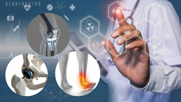 Different Types Of Joint Replacement Surgeries