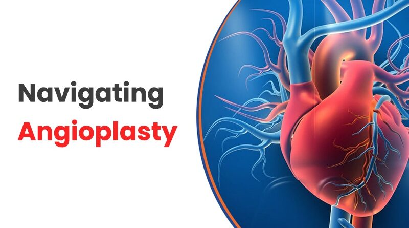 Navigating Angioplasty